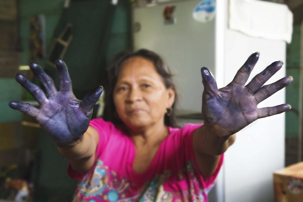 A woman shows her stained hands.